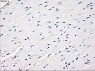 Immunohistochemistry-Paraffin: Leukotriene A4 Hydrolase/LTA4H Antibody (OTI1E9) [NBP1-47829]