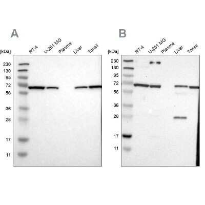 Western Blot: Leukotriene A4 Hydrolase/LTA4H Antibody [NBP1-90368]