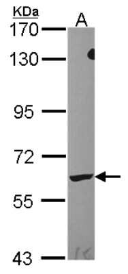 Western Blot: Leukotriene A4 Hydrolase/LTA4H Antibody [NBP2-19348]