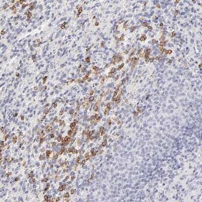 Immunohistochemistry-Paraffin: Leukotriene B4 R1 Antibody [NBP1-89959]