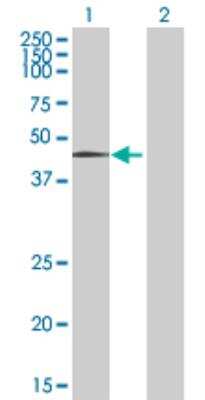 Western Blot: Leupaxin Antibody [H00009404-B01P]