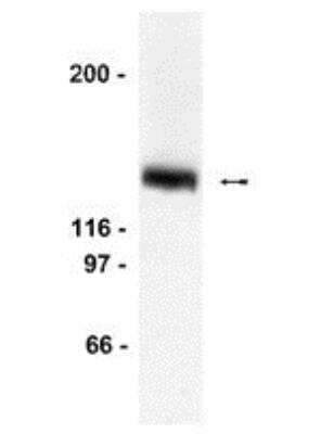 Western Blot: LexA DNA Binding Region Antibody [NB600-1137]