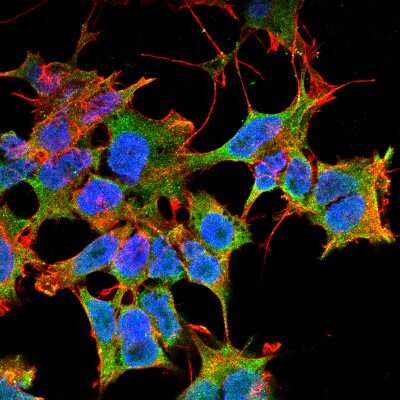 Immunocytochemistry/ Immunofluorescence: Lgi1 Antibody (S283-7) [NBP2-42190]