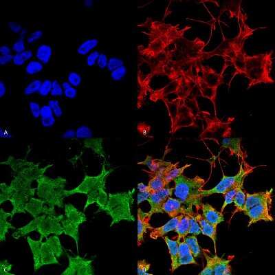 Immunocytochemistry/ Immunofluorescence: Lgi1 Antibody (S283-7) [NBP2-42190]