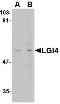 Western Blot: Lgi4 AntibodyBSA Free [NBP1-76381]