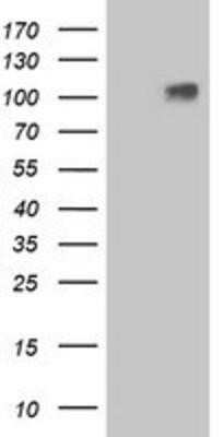 Western Blot: Lgr4/GPR48 Antibody (OTI2D1)Azide and BSA Free [NBP2-72006]