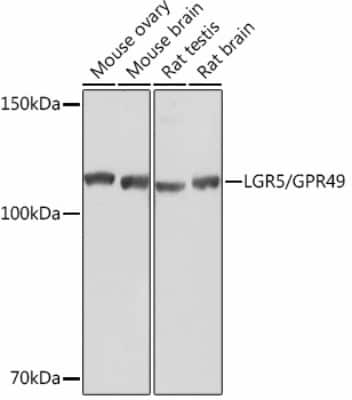 Western Blot: Lgr5/GPR49 Antibody (9J9B8) [NBP3-15445]