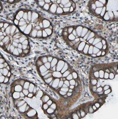 Immunohistochemistry-Paraffin: Lgr5/GPR49 Antibody [NBP2-54660]