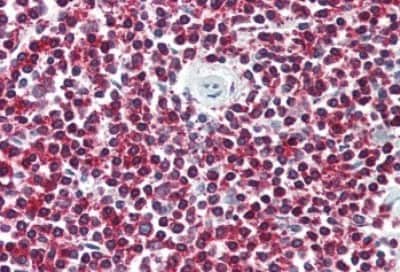 Immunohistochemistry-Paraffin: Lgr6 Antibody [NBP3-14391]