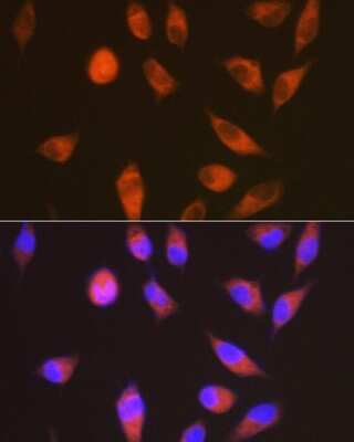 Immunocytochemistry/ Immunofluorescence: Lgr6 Antibody (8J2J10) [NBP3-16758]