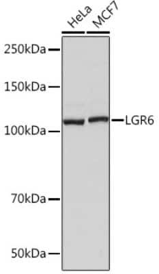 Western Blot: Lgr6 Antibody (8J2J10) [NBP3-16758]