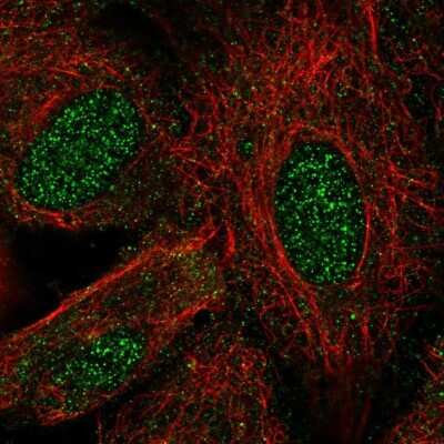 Immunocytochemistry/ Immunofluorescence: Lhx8 Antibody [NBP2-57782]