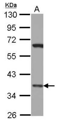 Western Blot: Lhx8 Antibody [NBP2-19350]