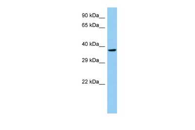 Western Blot: Lhx8 Antibody [NBP2-87722]