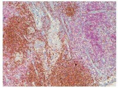 Immunohistochemistry-Paraffin: Lightning-Link (R) HRP Antibody Labeling Kit [701-0002]