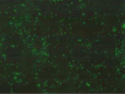 Immunocytochemistry/ Immunofluorescence: Lipid A LPS Antibody - BSA Free [NB100-64484]