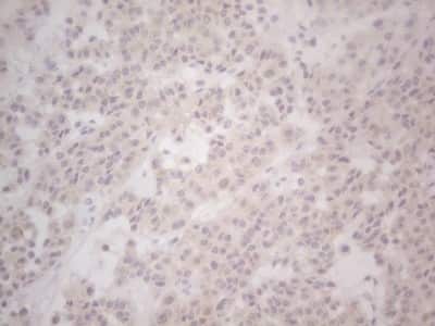Immunohistochemistry: Lipin 1 Antibody (OTI5B5) [NBP2-45671]