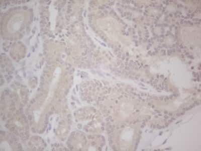 Immunohistochemistry: Lipin 1 Antibody (OTI5B5) [NBP2-45671]
