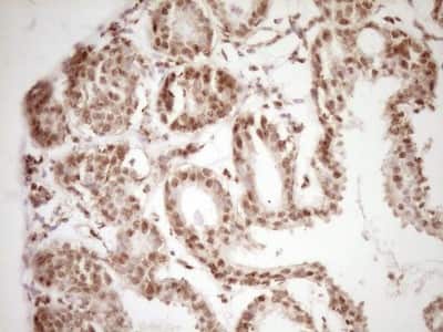 Immunohistochemistry: Lipin 1 Antibody (OTI8F10) [NBP2-45670]
