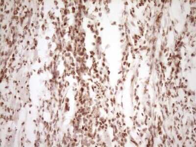 Immunohistochemistry: Lipin 1 Antibody (OTI8F10) [NBP2-45670]