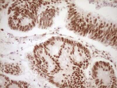 Immunohistochemistry: Lipin 1 Antibody (OTI8F10) [NBP2-45670]