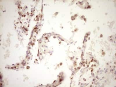 Immunohistochemistry: Lipin 1 Antibody (OTI8F10) [NBP2-45670]