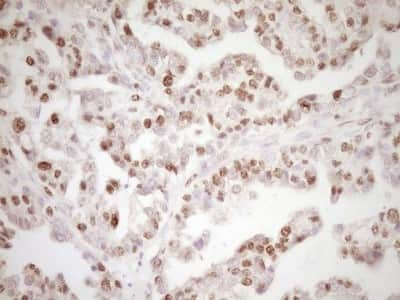 Immunohistochemistry: Lipin 1 Antibody (OTI8F10) [NBP2-45670]