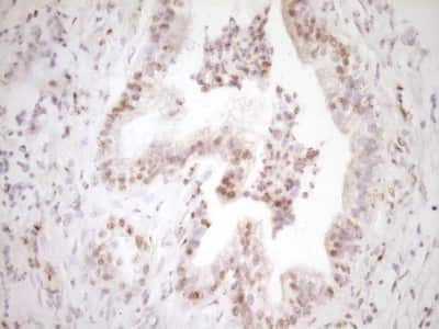 Immunohistochemistry: Lipin 1 Antibody (OTI8F10) [NBP2-45670]