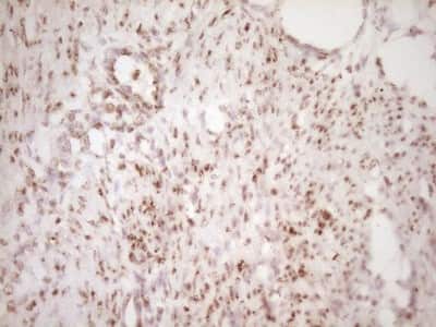 Immunohistochemistry: Lipin 1 Antibody (OTI8F10) [NBP2-45670]