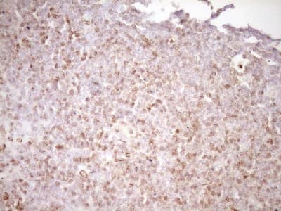 Immunohistochemistry: Lipin 1 Antibody (OTI8F10) [NBP2-45670]