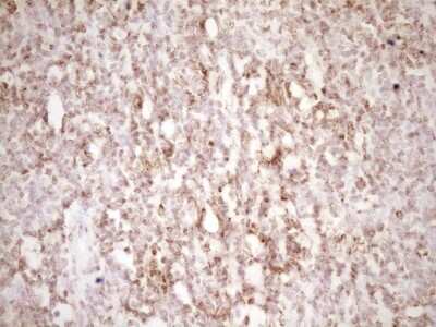 Immunohistochemistry: Lipin 1 Antibody (OTI8F10) [NBP2-45670]