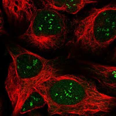Immunocytochemistry/ Immunofluorescence: Lipin 1 Antibody [NBP1-83030]