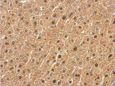 Immunohistochemistry-Paraffin: Lipin 1 Antibody [NBP2-19370]