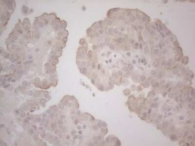 Immunohistochemistry: Lipin 1 Antibody (OTI5B5) - Azide and BSA Free [NBP2-71727]
