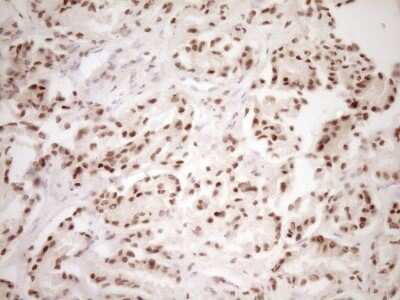 Immunohistochemistry: Lipin 1 Antibody (OTI8F10) - Azide and BSA Free [NBP2-71726]