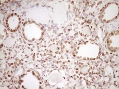 Immunohistochemistry: Lipin 1 Antibody (OTI8F10) - Azide and BSA Free [NBP2-71726]