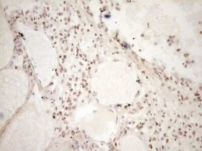 Immunohistochemistry: Lipin 1 Antibody (OTI8F10) - Azide and BSA Free [NBP2-71726]