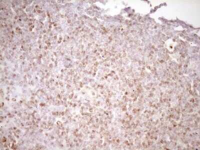 Immunohistochemistry: Lipin 1 Antibody (OTI8F10) - Azide and BSA Free [NBP2-71726]