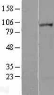 Western Blot: Lipin 2 Overexpression Lysate [NBL1-12654]