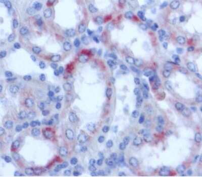 Immunohistochemistry-Paraffin: Lipocalin-2/NGAL Antibody (28) - BSA Free [NBP1-30006]