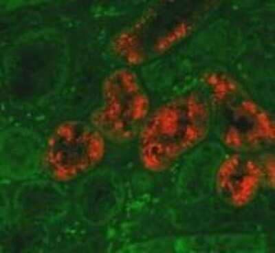 Immunohistochemistry: Lipocalin-2/NGAL Antibody (29) - BSA Free [NBP1-05183]