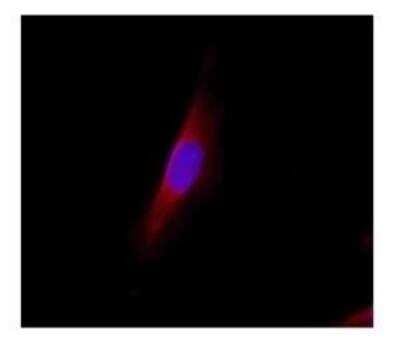 Immunocytochemistry/ Immunofluorescence: Lipocalin-2/NGAL Antibody [NBP1-45682]