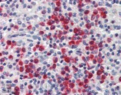 Immunohistochemistry-Paraffin: Lipocalin-2/NGAL Antibody [NB100-1503]