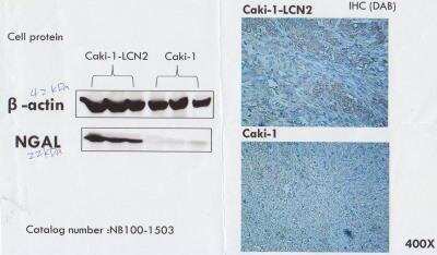 Immunohistochemistry-Paraffin: Lipocalin-2/NGAL Antibody [NB100-1503]