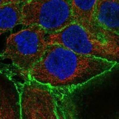 Immunocytochemistry/ Immunofluorescence: Lipolysis Stimulated Lipoprotein Receptor Antibody [NBP3-17879]