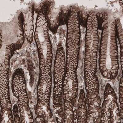 Immunohistochemistry-Paraffin: Lipolysis Stimulated Lipoprotein Receptor Antibody [NBP1-89631]
