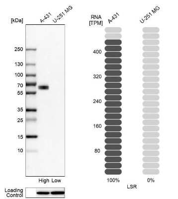 Western Blot: Lipolysis Stimulated Lipoprotein Receptor Antibody [NBP1-89631]