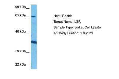 Western Blot: Lipolysis Stimulated Lipoprotein Receptor Antibody [NBP2-85213]