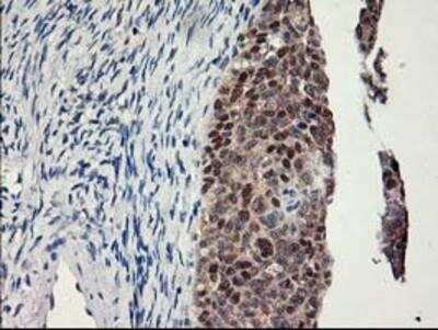 Immunohistochemistry-Paraffin: Lipoprotein Lipase/LPL Antibody (OTI3A10) [NBP2-01395]