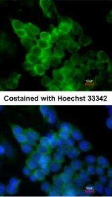 Immunocytochemistry/ Immunofluorescence: Lipoprotein Lipase/LPL Antibody [NBP1-32215]